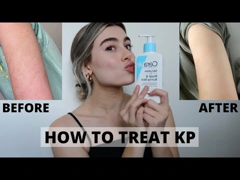 Dermatologist Partnerships and Social Proof